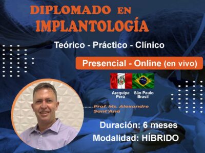 Implantología Oral (Diplomado 6 meses)